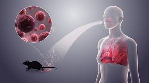 Recent Hantavirus Outbreak- 5/18/26